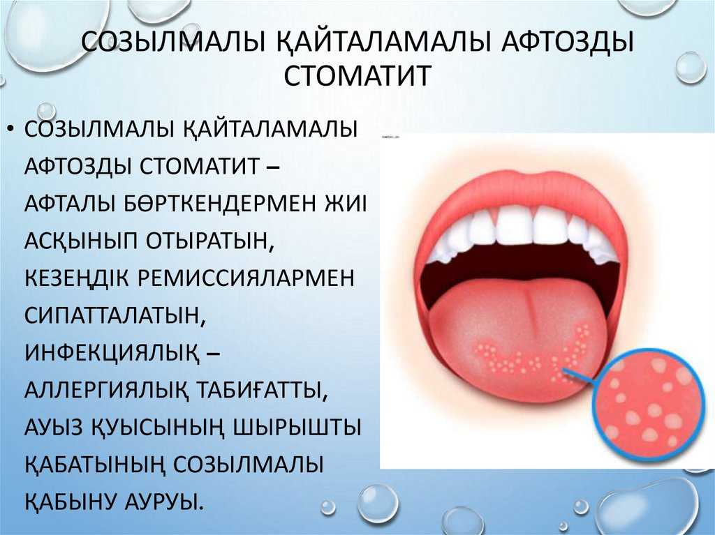 Белый налет на языке у взрослых: причины. почему на языке белый налет, что это значит и как лечить