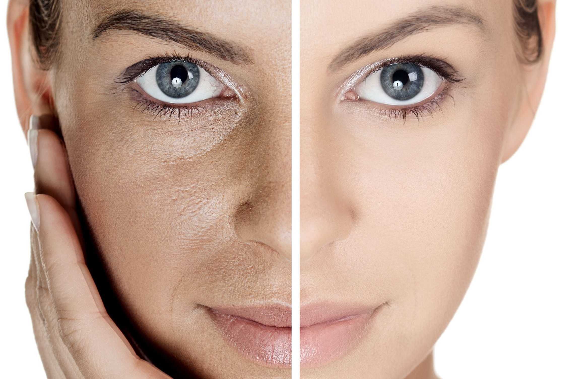 Возрастные изменения кожи | причины и признаки старения кожи лица