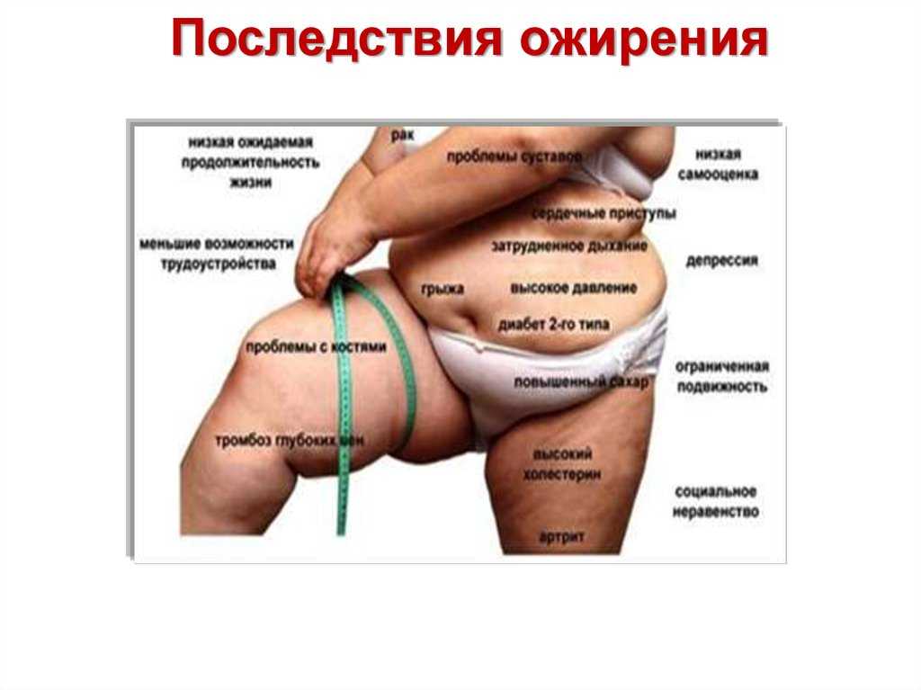 Как избавиться от жира на животе после 50