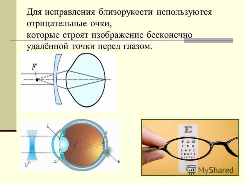 Линзы очков для близорукости. Очки для близорукости. Нстроение глаза при близорукости. Очки для коррекции миопии. Очки для исправления близорукости.