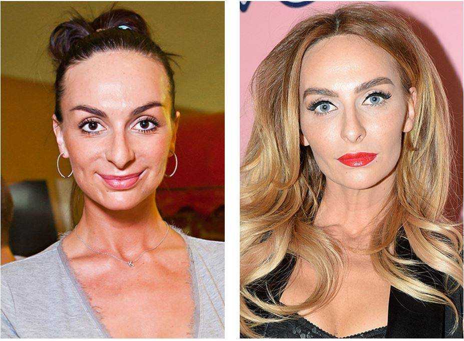Фото российских знаменитостей и голливудских звезд до и после пластики | qulady
