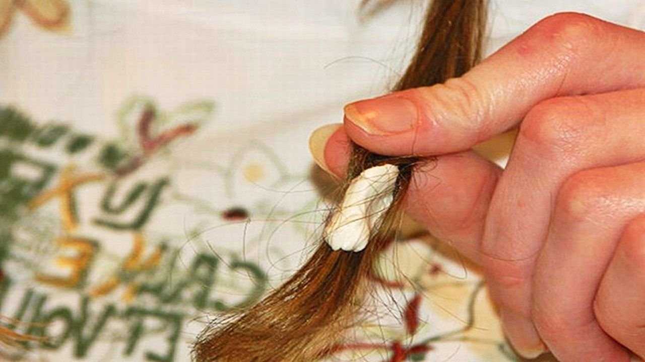 Как убрать жвачку с волос без ножниц и боли