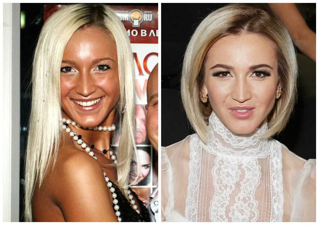 Как выглядели эти поп-звезды до и после пластической операции