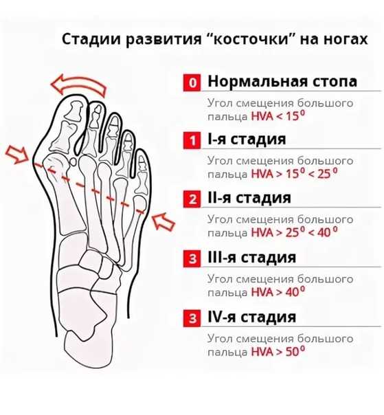 Почему немеют пальцы на ногах