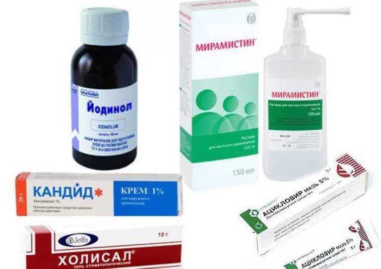 Причины белого налета на языке у ребенка