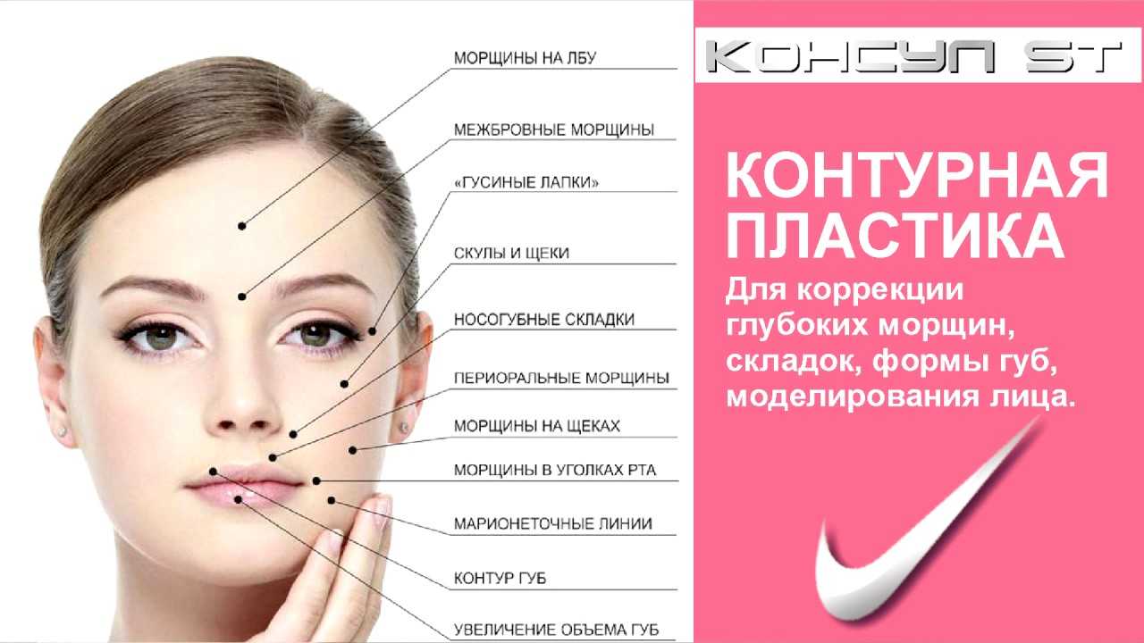 Асимметрия лица